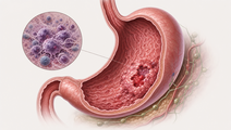 ramucirumab plus docetaxel shows phase ii activity in gastric cancer