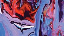 Relapse Management in Multiple Sclerosis Corticosteroids Remain the Linchpin of Therapies