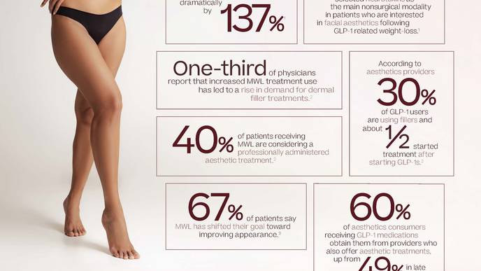 Infographic