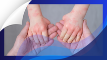 ReachMD Healthcare Image