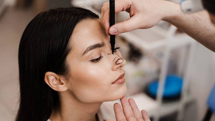 rhinoplasty