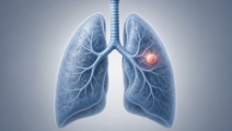 real world first line alk tki comparisons in alk positive nsclc
