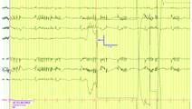PN0925 EE Fig 2C