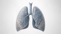 Illustrated lungs with subtle peripheral fibrosis representing pulmonary fibrosis care experiences of patients and partners