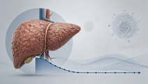long term hbv dna response patterns track outcomes in cirrhosis
