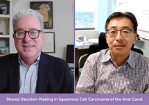Shared Decision-Making in Squamous Cell Carcinoma of the Anal Canal