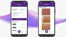 Swiftscope