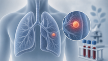 delfi announces first clinical utility data for lung screening at ats 2026