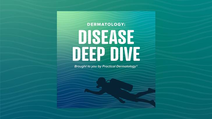 Deep Dive