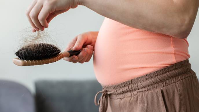 alopecia in pregnancy