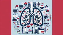 Pulmonary Embolism Evaluating the Impact of Response Teams on Patient Outcomes