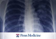 A Thoracic Surgeon's Viewpoint on Screening, Diagnosis and Treatment of a Lung Cancer Patient