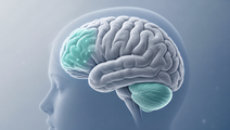dual site aitbs reduces suicidal ideation in adolescents with mdd
