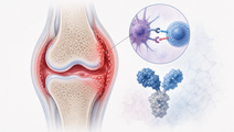 Checkpoint Inhibitor Rheumatic Toxicity in ERIN Registry