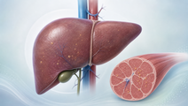 Human liver with reduced fat droplets and adjacent skeletal muscle cross section in type 2 diabetes