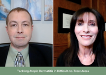 Tackling Atopic Dermatitis in Difficult-to-Treat Areas