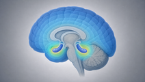Hippocampal Avoidance WBRT Planning Improved with 4A HG