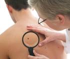 Skin Cancer 2024 Trends and Updates