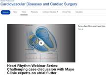 Heart Rhythm Webinar Series Challenging case discussion with Mayo Clinic experts on atrial flutter