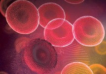 Enhancing Diagnosis Treatment and Outcomes in PNH with Novel Oral Therapeutics