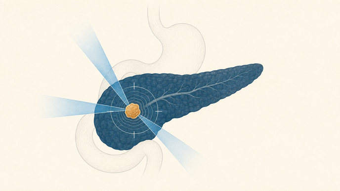 ASTRO Updates Pancreatic Cancer Radiation Guideline