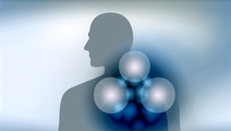 SABR Therapy Deemed Safe for Extensive Cancer Spread