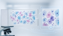 deep learning assistance versus manual reading in cervical cytopathology