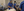 Figure 5. Auto keratometry and immersion A-scan ultrasound were performed in the OR, after which the IOL calculation was performed.