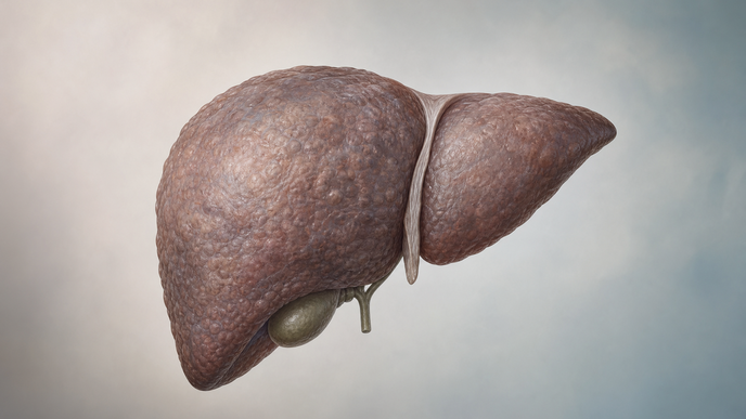 Editorial illustration of a liver with subtle cirrhotic texture representing decompensated cirrhosis