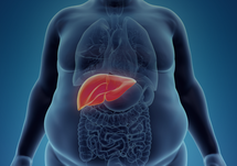 The NASH Epidemic: Highlights from the AMCP 2023 Symposium