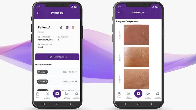 Swiftscope