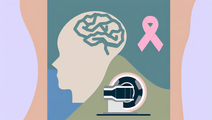 Rethinking Brain MRI Screening in Asymptomatic Stage 4 Breast Cancer Patients