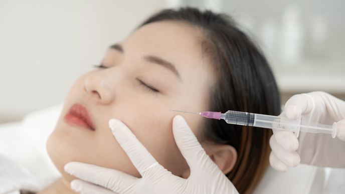 Hyaluronic acid filler