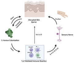 The Complex and Heterogeneous Pathophysiology of Atopic Dermatitis ...
