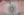 Figure 4. At the beginning of surgery, this pupil, even though it was not fully dilated, was large enough to allow creation of the capsulorhexis.