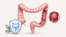 colonoscopy screening lowers incidence but not mortality after 13 years