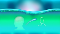 Understanding Comorbidities in Alopecia Areata