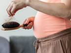 alopecia in pregnancy