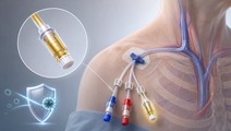 4 tetrasodium edta lowers cvad complications in icu trial