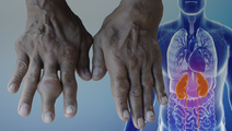 ReachMD Healthcare Image