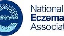 NEA