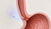 zanidatamab regimens vs trastuzumab in her2 positive gea