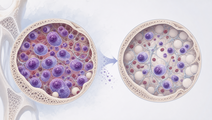 talquetamab and daratumumab in relapsed or refractory myeloma