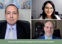Chronic Hand Eczema Subtypes and Treatment Strategies