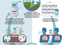 How Aspergillus Develops Antifungal Resistance and Causes Illness