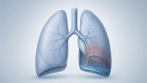 non drug perioperative strategies for ppc prevention after abdominal surgery