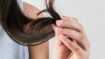 Alopecia