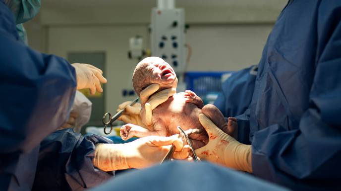 How Gut Bacteria Differs Between Vaginally Born & Cesarean-Delivered ...