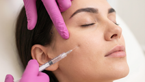 modern aesthetics cheek filler