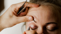 blepharoplasty